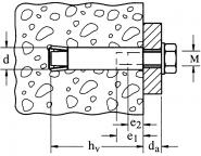 Fischer Zykon-Innengewindeanker   060758 